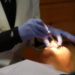 Jakie korzyści daje zastosowanie implantu zębowego?