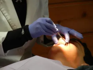 Jakie korzyści daje zastosowanie implantu zębowego?